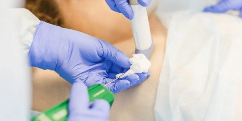 Tham khảo thông tin những điều mà bác sĩ ít tiết lộ